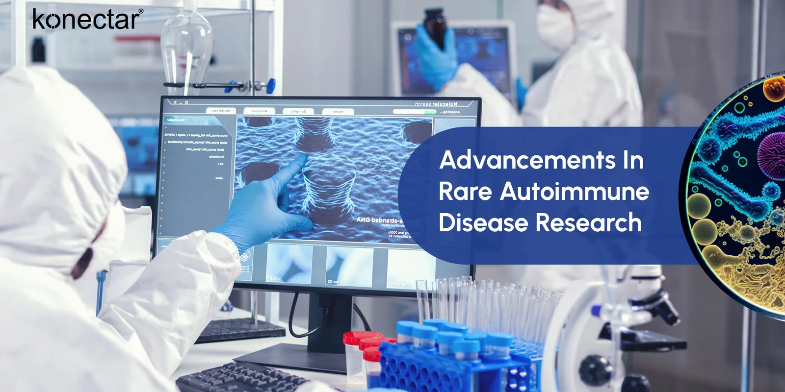 Advancements in Rare Autoimmune Disease Research